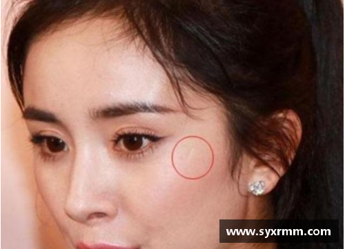体育明星眼皮疤痕揭秘：你不知道的伤痕背后的故事